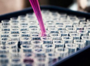 pesquisa-ve-potencial-em-solo-amazonico-para-desenvolver-medicamentos